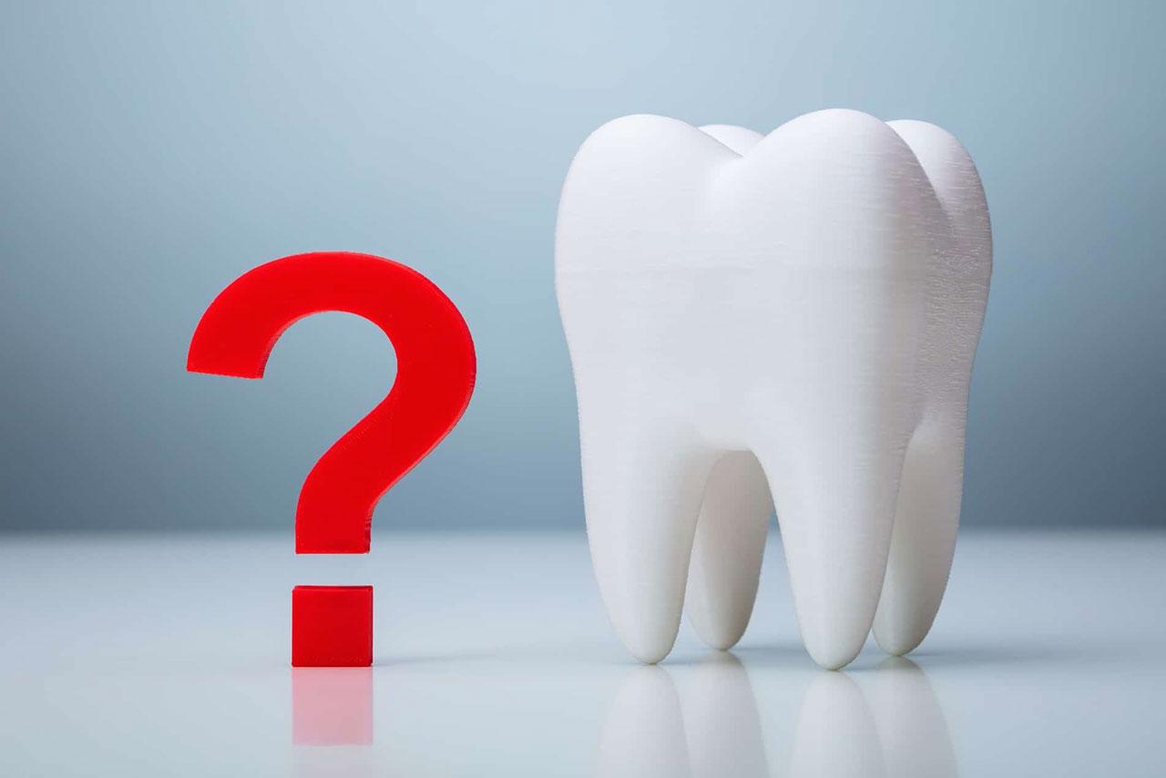 Le domande più frequenti che i pazienti fanno al dentista.
